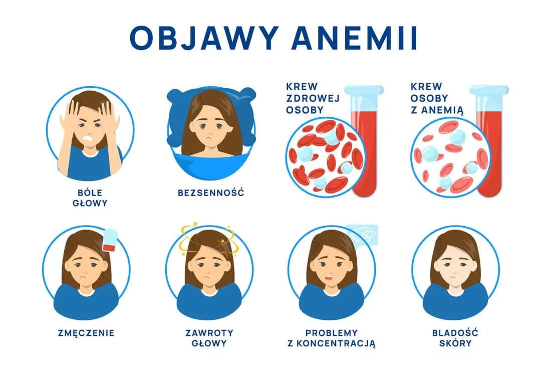 Anemia objawy psychiczne: jak niedokrwistość wpływa na twoje samopoczucie