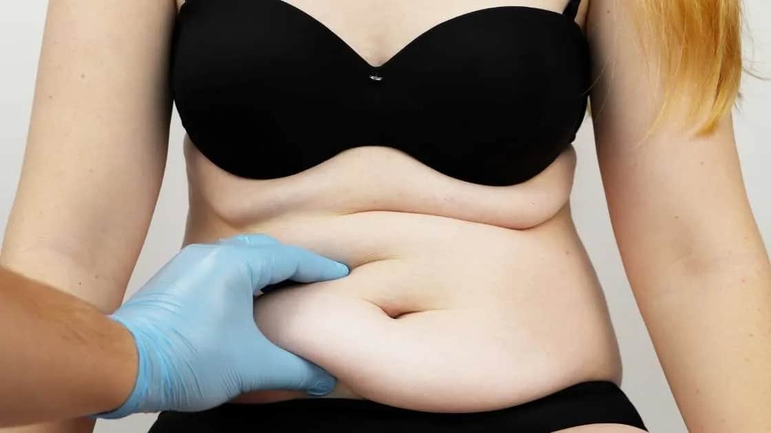 Plastyka brzucha nfz gdzie uzyskać refundację i uniknąć kosztów