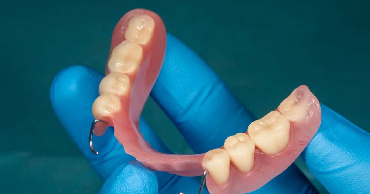 Czy NFZ refunduje protezy zębowe? Sprawdź, co musisz wiedzieć