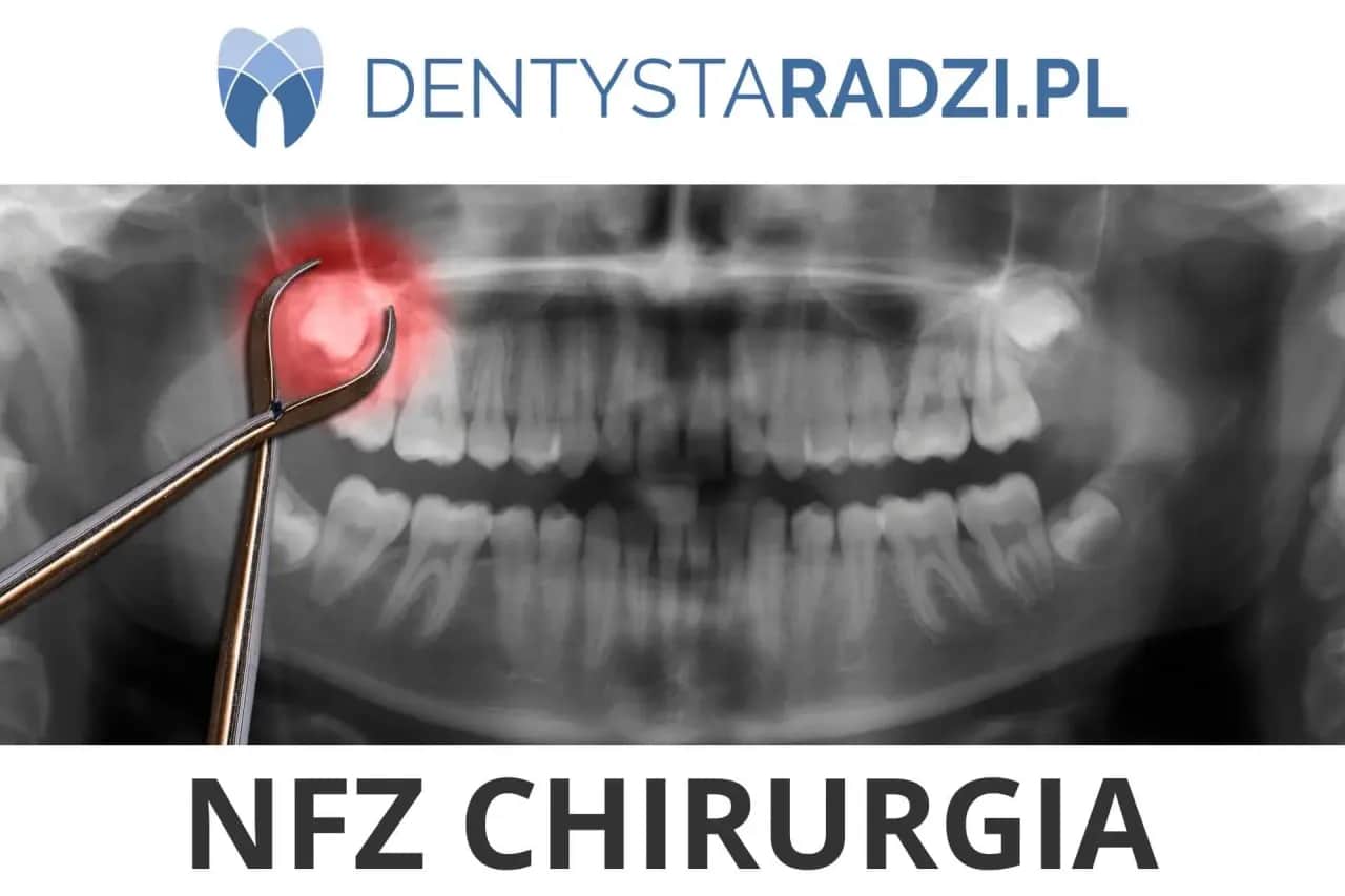 Gdzie wyrwać zęba na NFZ? Znajdź darmowe usunięcie zęba bez bólu
